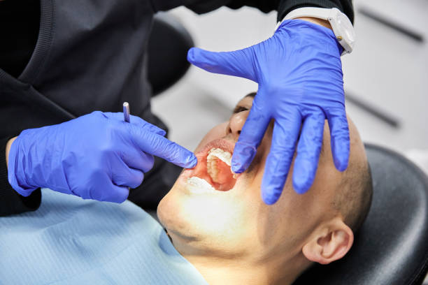 Best Emergency Dentist for Lost Fillings or Crowns in Clinton, IL