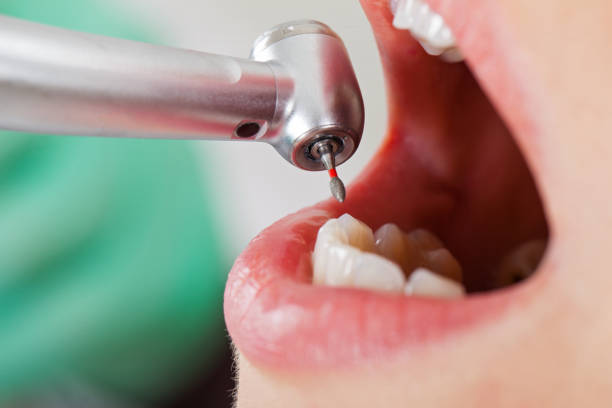 Best Pediatric Emergency Dentist in Clinton, IL